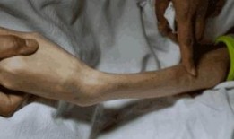 骨瘦如柴 在线观看,揭示人生低谷的励志故事